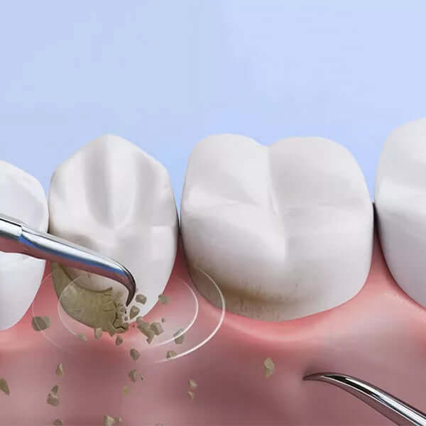 Tandreiniger met Ultrasound Technologie