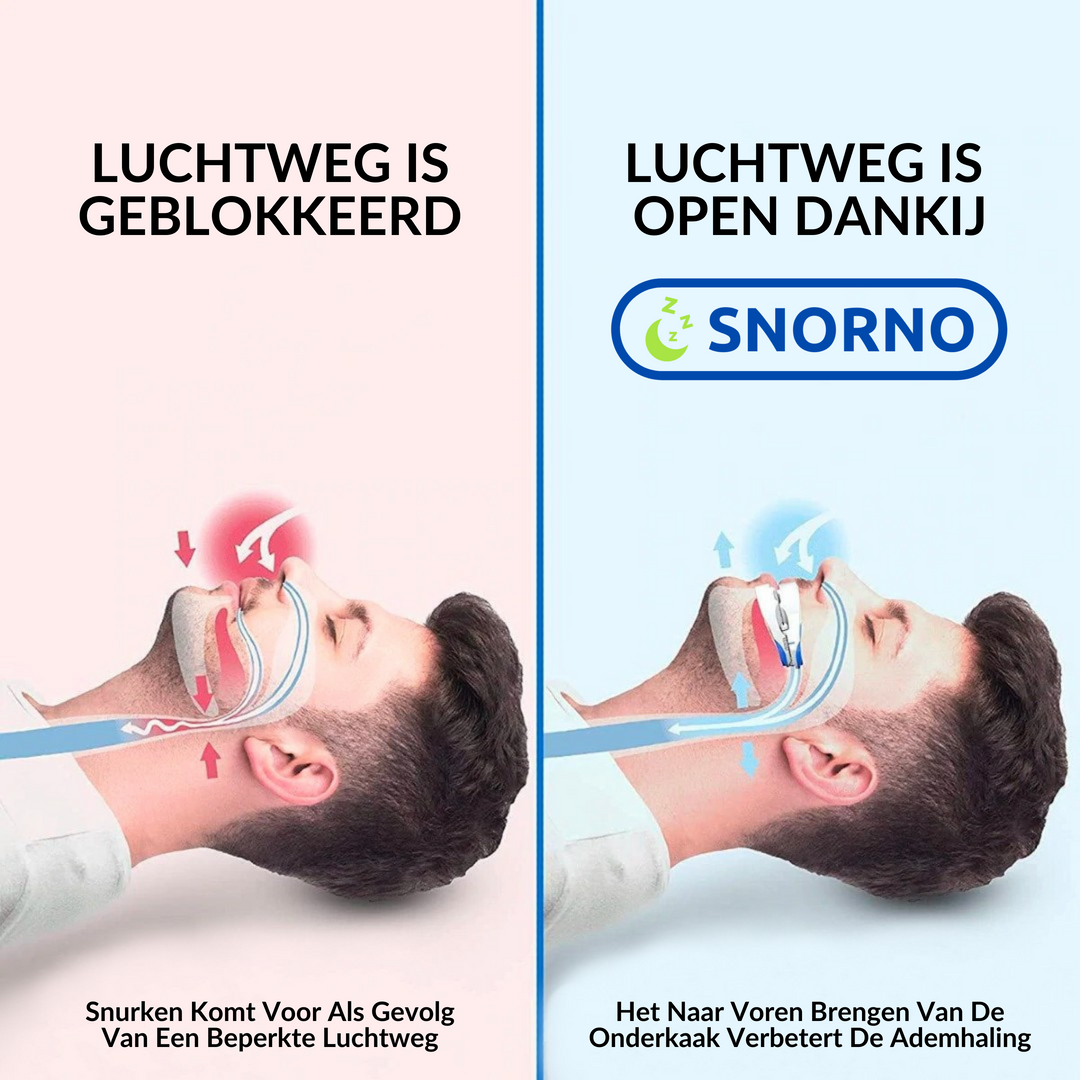 Zeg vaarwel tegen snurken met dit hypoallergene slaap mondstuk; voor ongestoorde nachten.