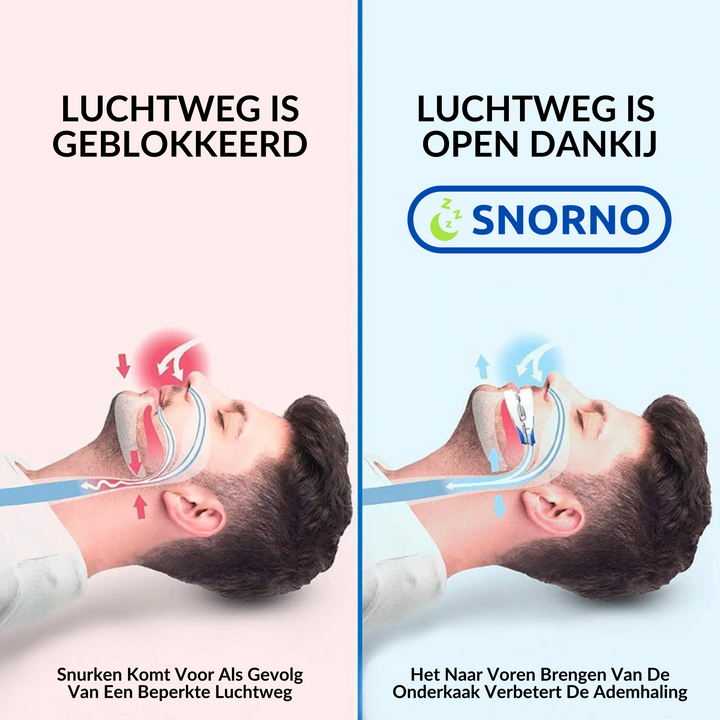 Zeg vaarwel tegen snurken met dit hypoallergene slaap mondstuk; voor ongestoorde nachten.
