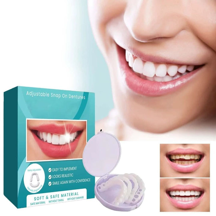 Eenvoudig aan te brengen snap-on gebitsprothese, voor direct mooie tanden en een esthetische glimlach.