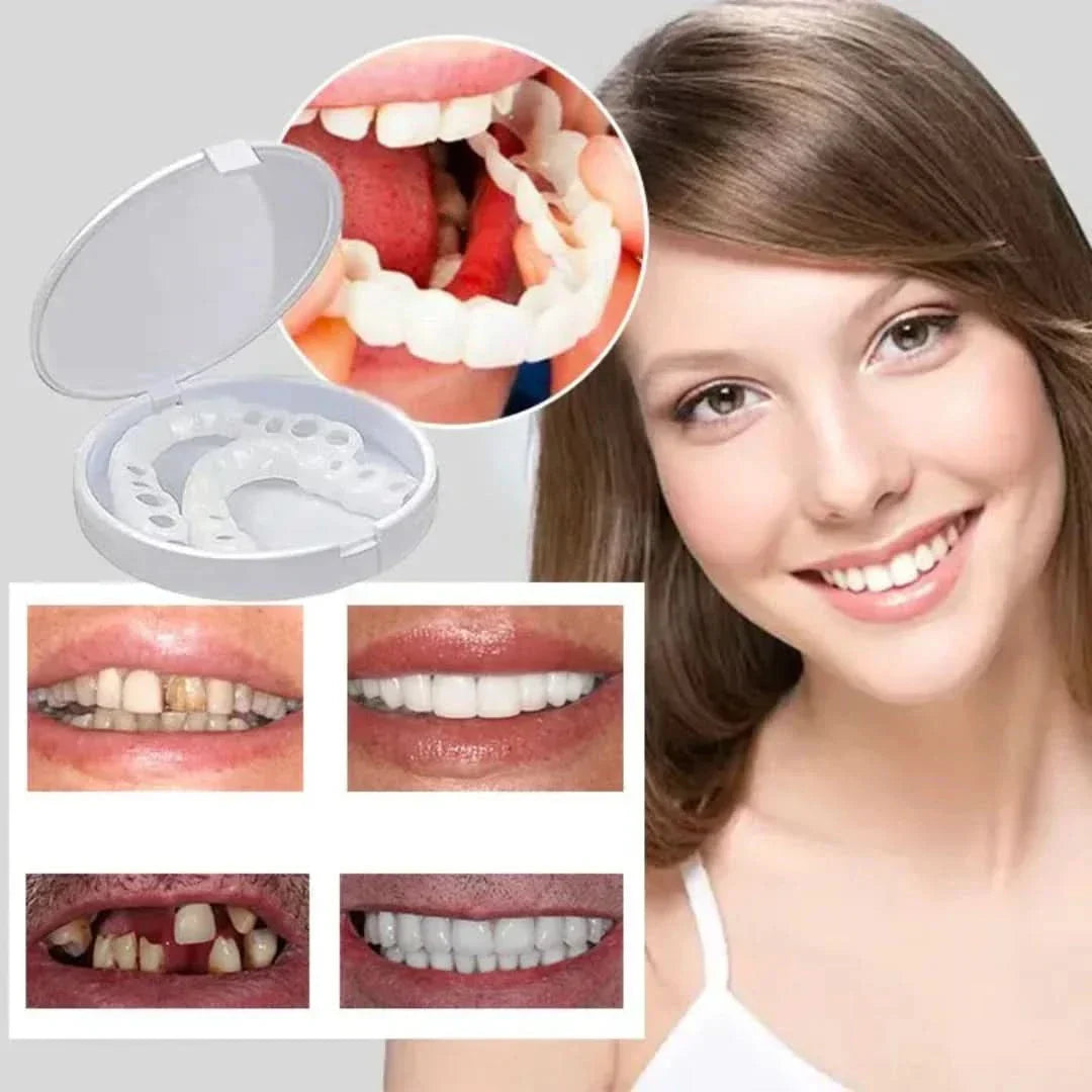 Herbruikbare siliconen gebitsprothese, verstelbaar cosmetisch nepgebit voor een perfecte, comfortabele pasvorm.