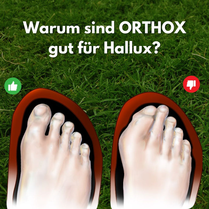 Blauwe herenschoenen voor Hallux Valgus, ademend met brede teenbox, ideaal bij Hallux Valgus.