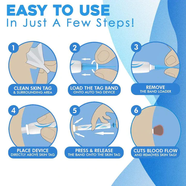 Huidverwijderingskit, pijnloze reiniger, set: verwijderingsbanden, geleideringen, huidtagverwijdering, zacht en effectief.