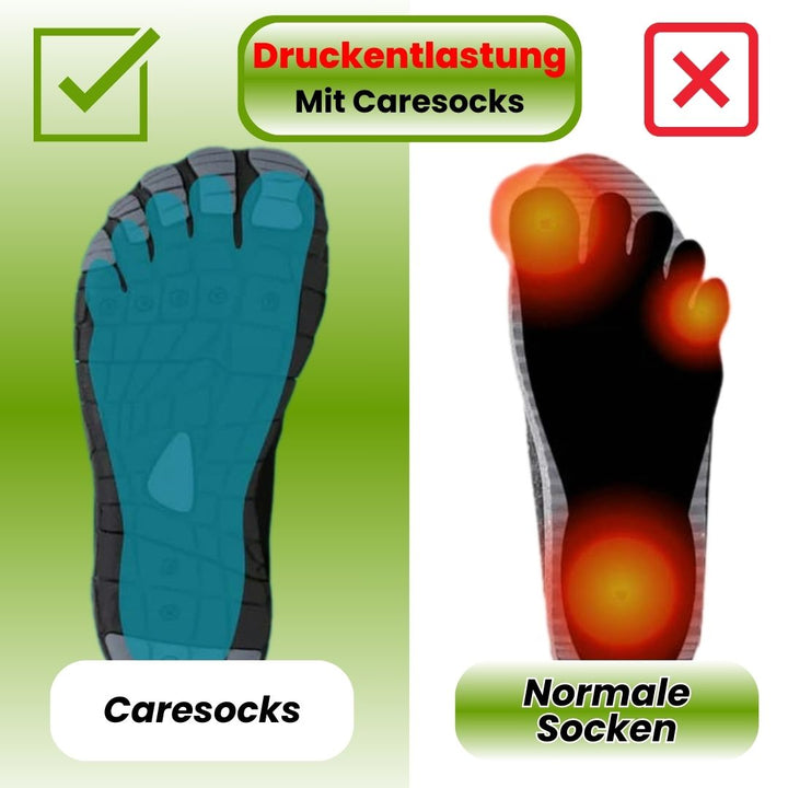 Dames compressiesokken in huidskleur, elastisch met gerichte compressie voor het verlichten van hiel- en voetpijn.