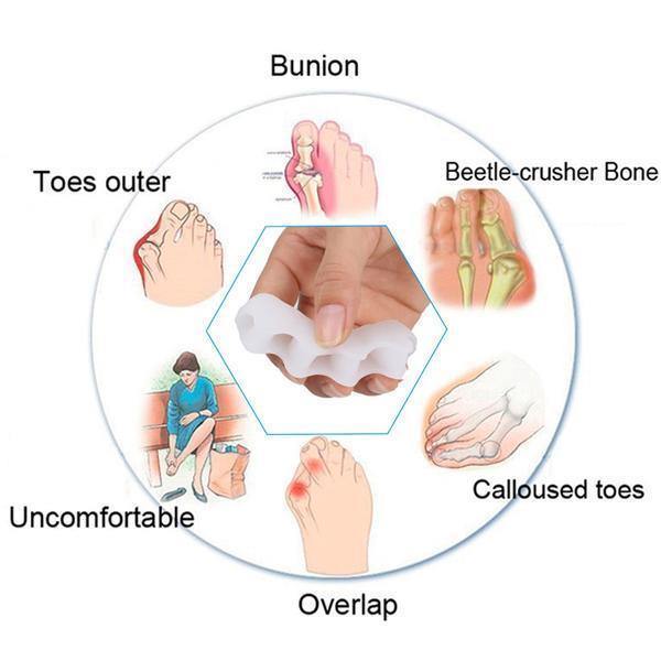 Orthopedische teen corrector: Huidskleurig, flexibel ontwerp, voor comfort en verlichting bij hallux valgus en hamertenen.