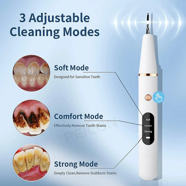Close-up van de SonicClean ultrasone scaler. Essentieel voor professionele gebitsreiniging en mondhygiëne thuis.