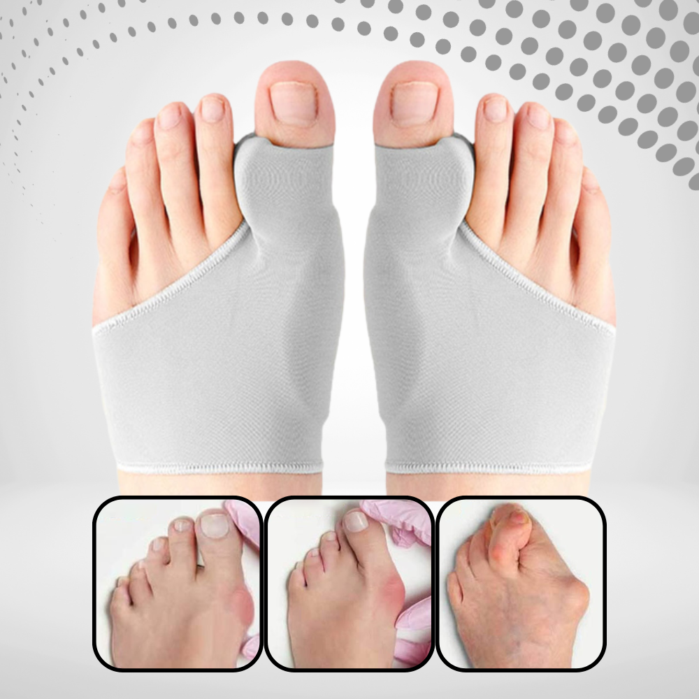 Deze hallux valgus corrector met gelpad zorgt voor optimale teen uitlijning & langdurige pijnverlichting.